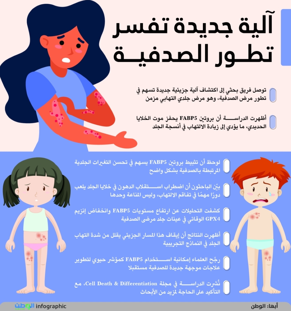 آلية جديدة تفسر تطور الصدفية