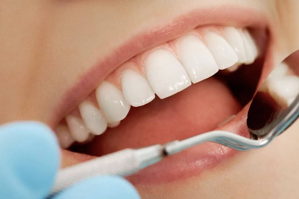 وتد طبي جديد بديل لزراعة الأسنان 